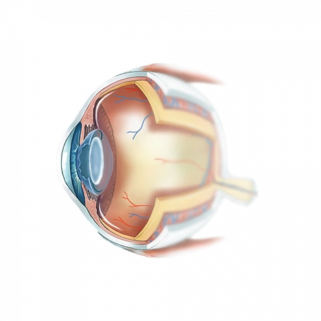 Implant intra-oculaire
