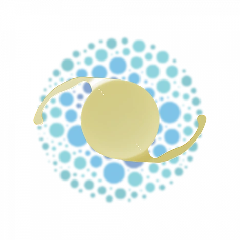 Illustration de la sélection d'implants