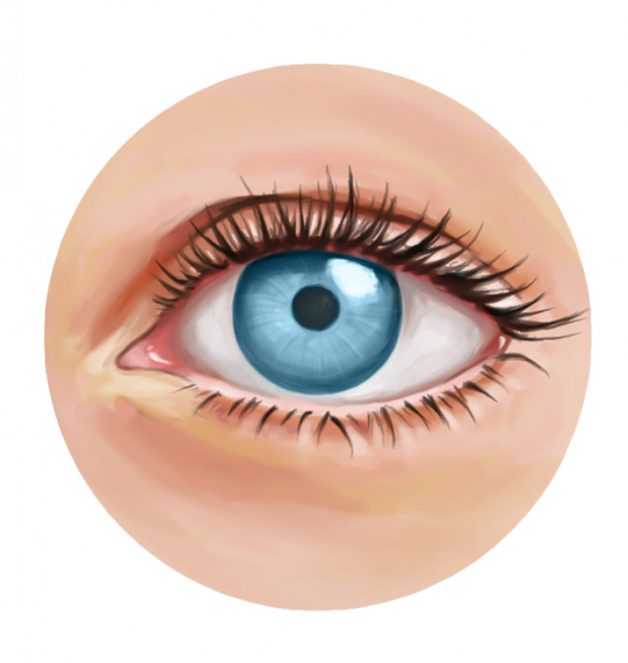 Illustration de la sélection d'implants